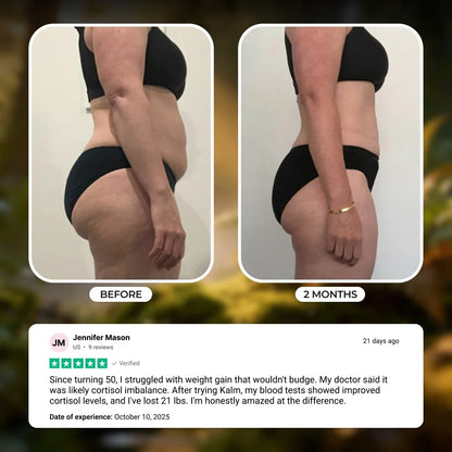 Kalm Bracelet | Your Weight Loss Solution