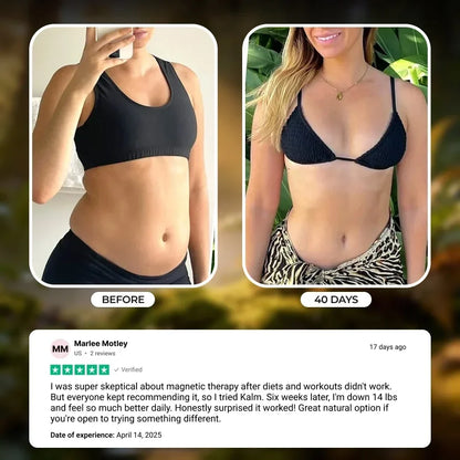 Kalm Bracelet | Your Weight Loss Solution